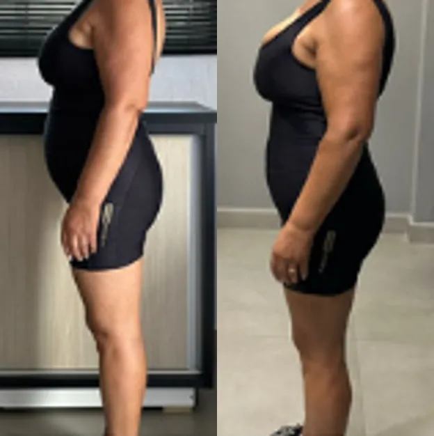 Antes e depois de uma aluna, de perfil, de macaquinho preto. À esquerda, o início; à direita, a foto mais recente.